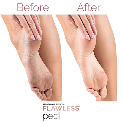 أداة باديكير للعناية بالقدمين Flawles Pedi